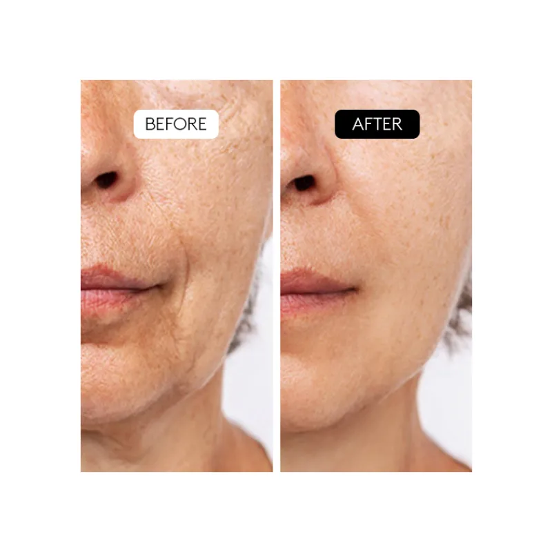 Best Aha Complex 10% Niacinamida|Aha/Bha