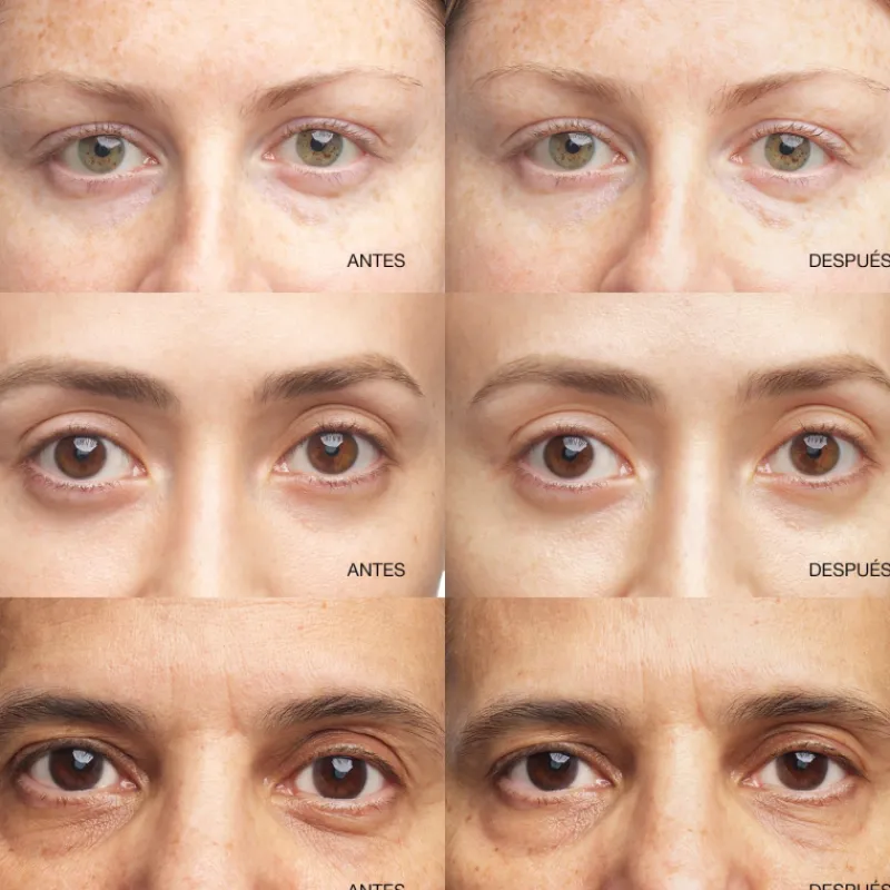 Sale All About Eyes Brightening Serum Luminosidad|Tratamiento