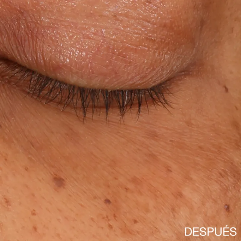 Sale All About Eyes Brightening Serum Luminosidad|Tratamiento