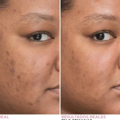 Hot BYE BYE DARK SPOTS SERUM 30 ML Vitamina A|Vitamina C