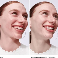 New BYE BYE REDNESS SERUM Tratamiento