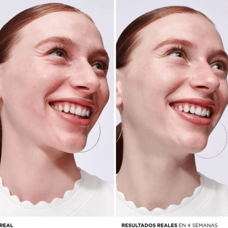 New BYE BYE REDNESS SERUM Tratamiento