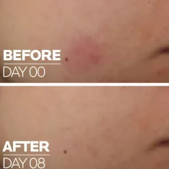 New CICAPLAST B5 SÉRUM CON 10 % DE VITAMINA B5 Facial