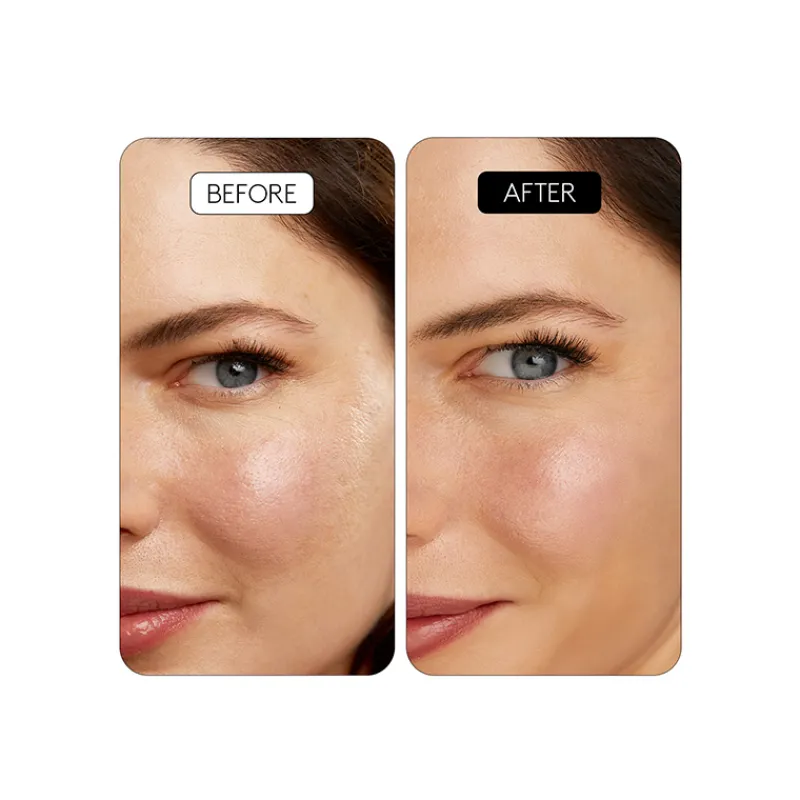 Online Clinical Retinal 0.1 Niacinamida|Acido Hialurónico