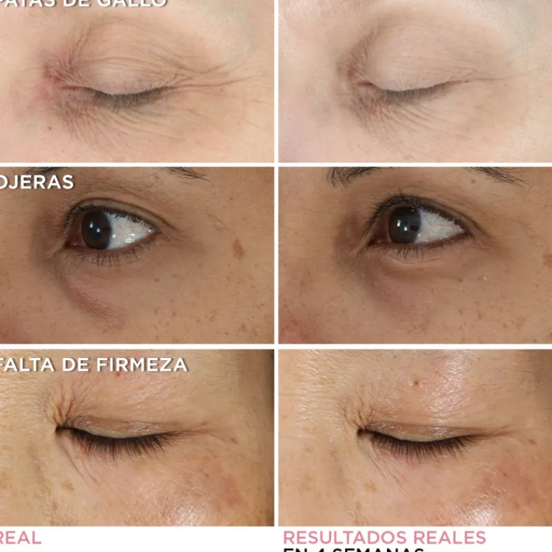 Clearance CONFIDENCE IN AN EYE Luminosidad|Arrugas
