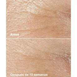 Best CREMA ANTIEDAD SMART CLINICAL REPAIR WRINKLE CORRECTING CREAM EDICIÓN LIMITADA Arrugas|Tratamiento
