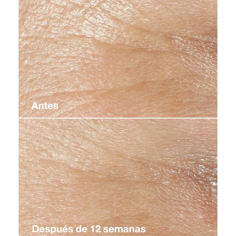 Best CREMA ANTIEDAD SMART CLINICAL REPAIR WRINKLE CORRECTING CREAM EDICIÓN LIMITADA Arrugas|Tratamiento