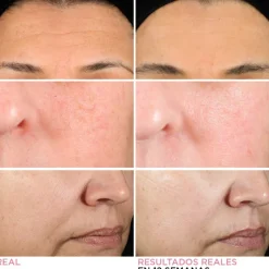 Hot HELLO RESULTS PRSD RETINOL 50ML Vitamina E|Vitamina A