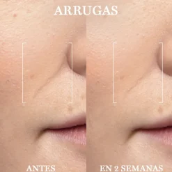 LANCÔME RÉNERGIE H.C.F. TRIPLE SERUM Karité|Miscelas