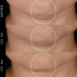 Clearance RENERGIE CREAM REFILL Niacinamida|Arrugas