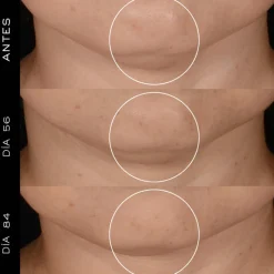 Outlet RENERGIE H.P.N. 300-PEPTIDE CREAM Niacinamida|Arrugas