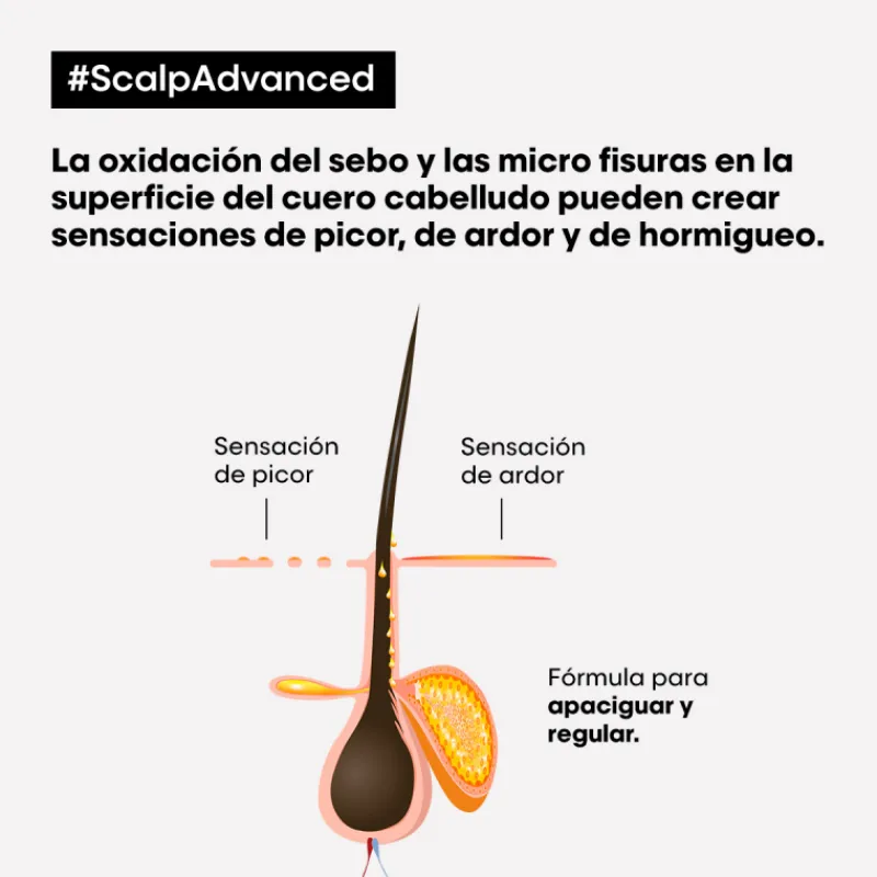Discount SCALP ADVANCED ANTI-DISCOMFORT CONDITIONER Acondicionador