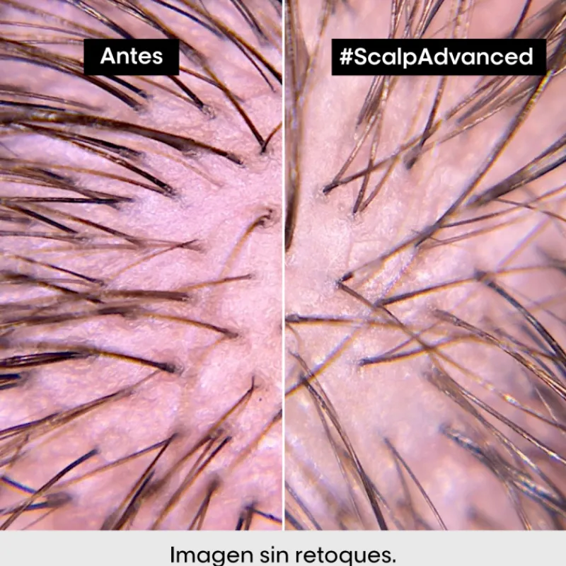 Discount SCALP ADVANCED ANTI-DISCOMFORT CONDITIONER Acondicionador