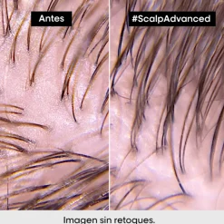 Hot SCALP ADVANCED ANTI-OIL SHAMPOO Shampoo