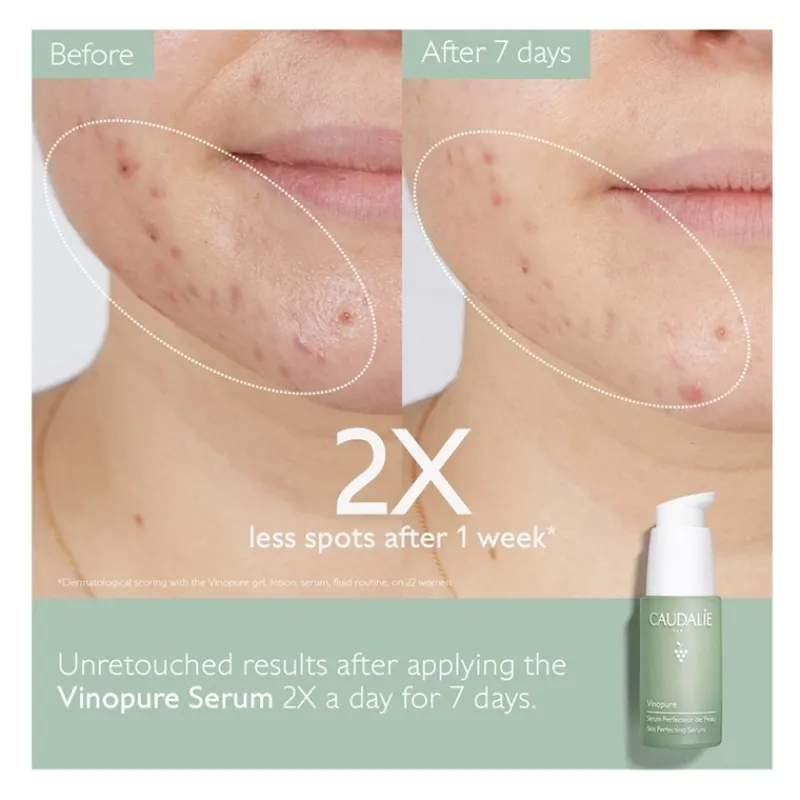 Hot Set Sérum Vimopure + Vinopure Stop Granos Regalo Estuches|Facial