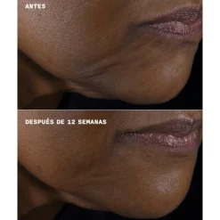 SMART CLINICAL REPAIR LIFTING FACE + NECK CREAM Acido Hialurónico|Arrugas