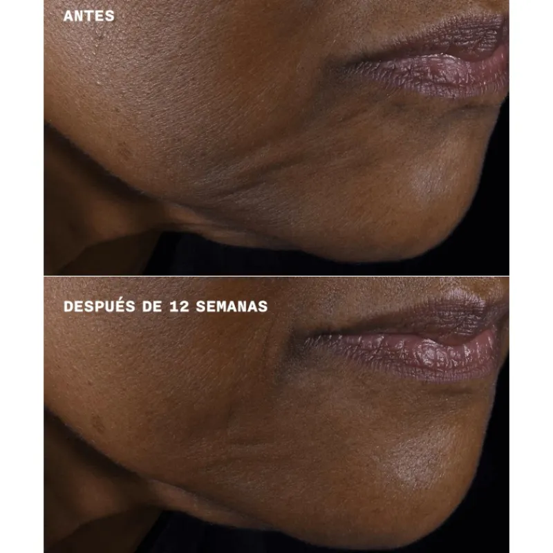 SMART CLINICAL REPAIR LIFTING FACE + NECK CREAM Acido Hialurónico|Arrugas