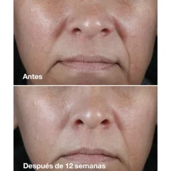 Sale SMART CLINICAL REPAIR WRINKLE CORRECTING RICH CREAM 50ML Acido Hialurónico|Arrugas