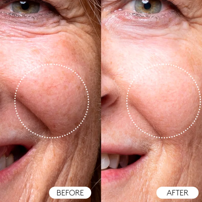 Best The Real C Vitamina E|Vitamina A