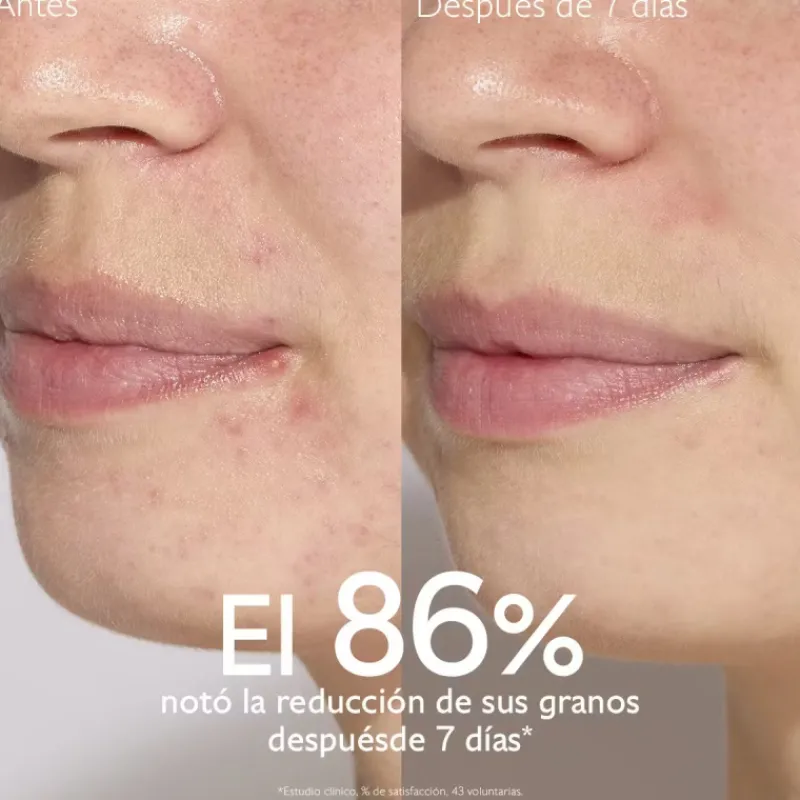 New Vinopure Sérum con Acido Salicílico Anti-imperfecciones Facial