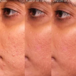 New Vinopure Sérum con Acido Salicílico Anti-imperfecciones Facial