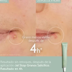 Sale VINOPURE STOP GRANOS SALICÍLICO Facial